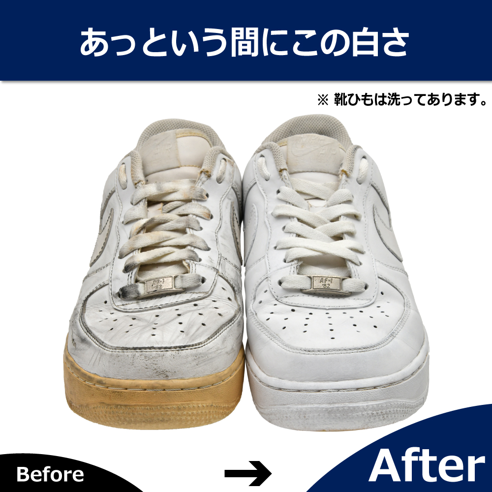 塗って補色するホワイトニングクリーム